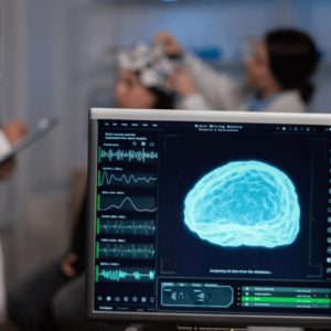 EEGSIM™ – Simulador de electroencefalogramas - Accurate